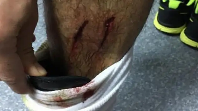 Konyaspor'dan dev isyan! Ayağı bu halde