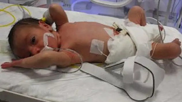 Doğar doğmaz ameliyata alındı