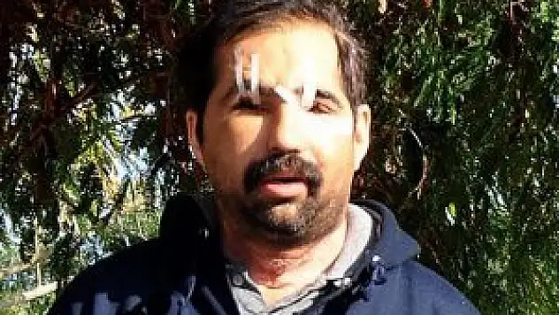 Türkiye'nin 6. yüz nakli yapılan Sülün hayatını kaybetti