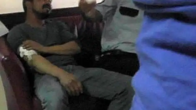 ÇEKİÇLE ÇAKTIĞI DEMİRİN PARÇASI KOLUNA SAPLANDI