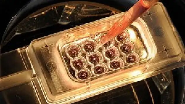 DSÖ, Ebola ile mücadele için Gine'ye merkez kuruyor