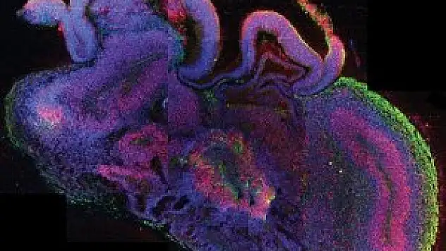 Bilincin 'açma/kapama düğmesi' bulundu