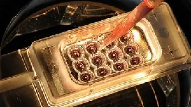 Ebola salgını 4 günde 25 can aldı