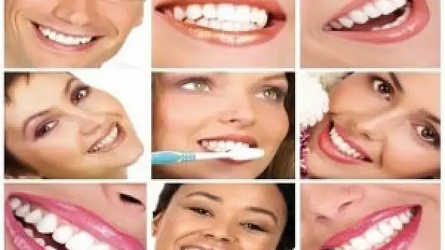 Diş bakımı yazın önem kazanıyor