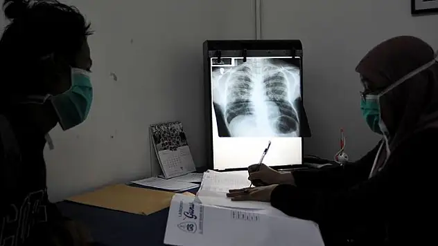 Dünyada her gün yaklaşık 4 bin 500 kişi veremden ölüyor