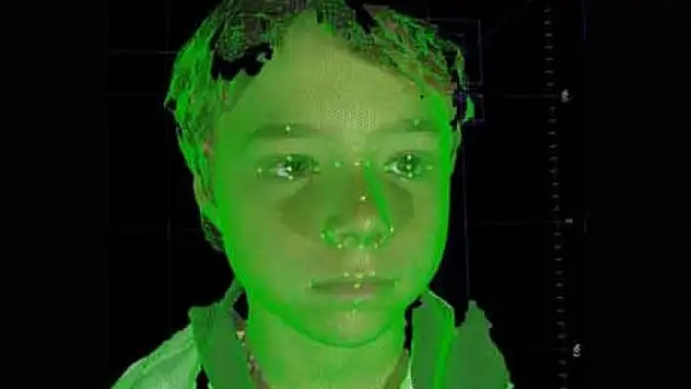 Üç boyutlu yüz teknolojisi çocuk hastalıklarını ortaya çıkarıyor