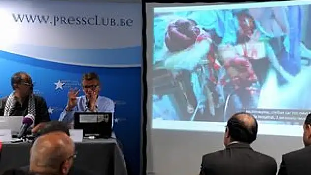 'Hayatımda bu kadar kan görmedim'