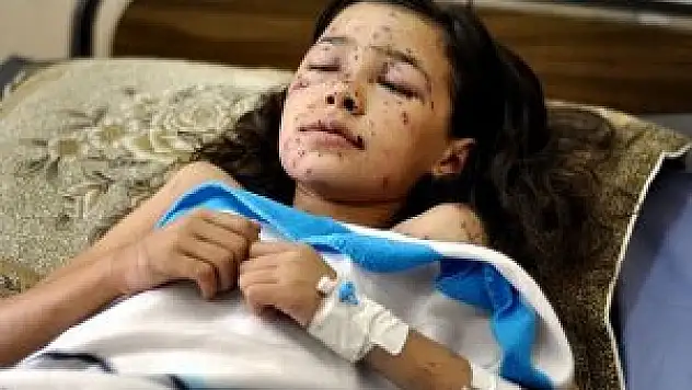 Bir çocuğun daha dünyasını kararttı