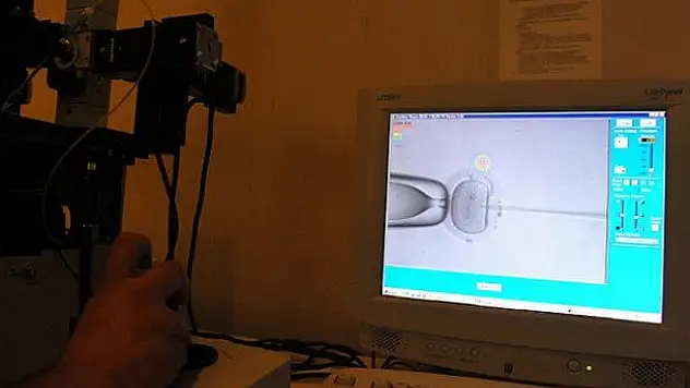 Tüp bebekte dünyada 7. sıradayız