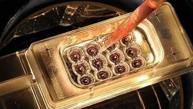 Ebola salgınında ölü sayısı artıyor