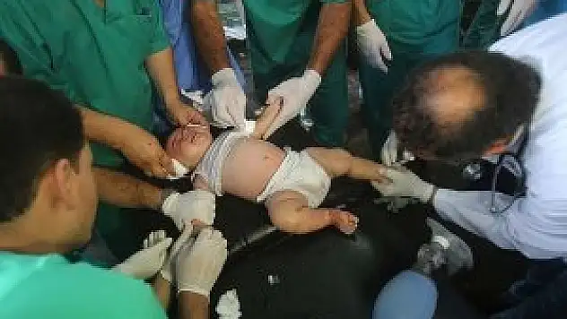 Gazze'de görevli doktorların ruh sağlığı bozuldu