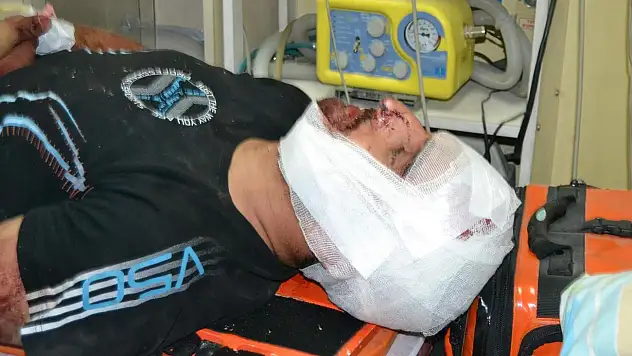 Motosiklet çarptı, kulağı koptu!