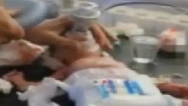 Kafasında şarapnel parçasıyla doğdu