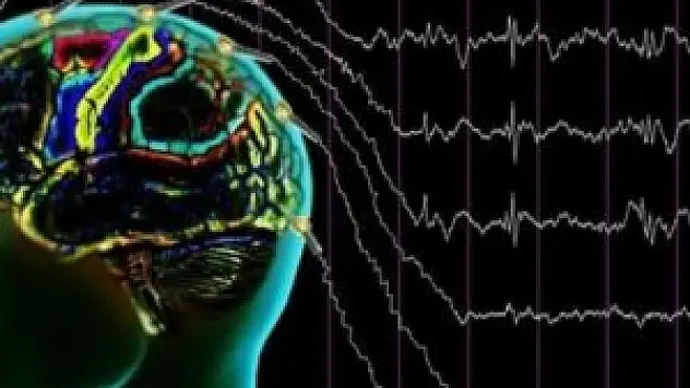 Frankeştayn gerçek oluyor: Hafıza elektrik ile güçlenecek