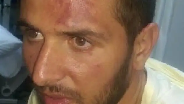 Maç sonrası dövdüler, öldü diye bıraktılar!