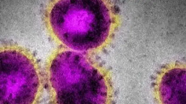 Philadelphia kromozomunu duymuş muydunuz?