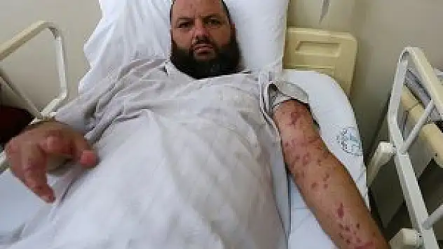 Diyabet hastası olduğunu Türkiye'de öğrendi