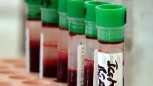 Kanseri önleyici proje üretildi