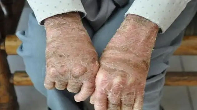 Bakan Koca'dan müjde! O ilaç Eylül'de piyasada