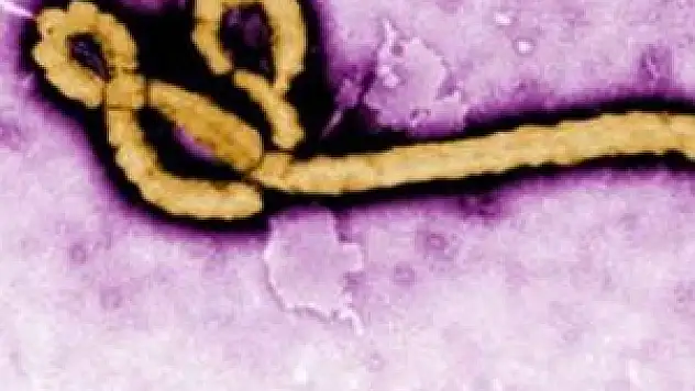 Arjantin'de ebola alarmı!