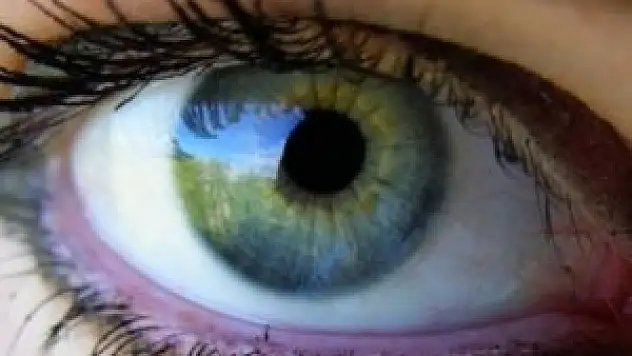 Göz kapağı sorunları çaresiz değil