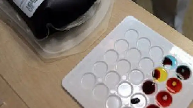 Nadir görülen bir grup ortaya çıktı