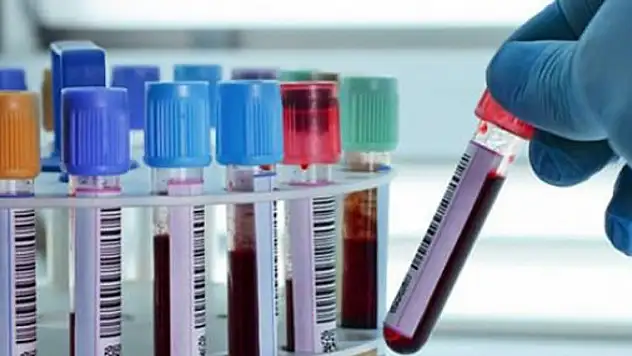 Tek kan testiyle 20 kanser türü tespit edilebiliyor