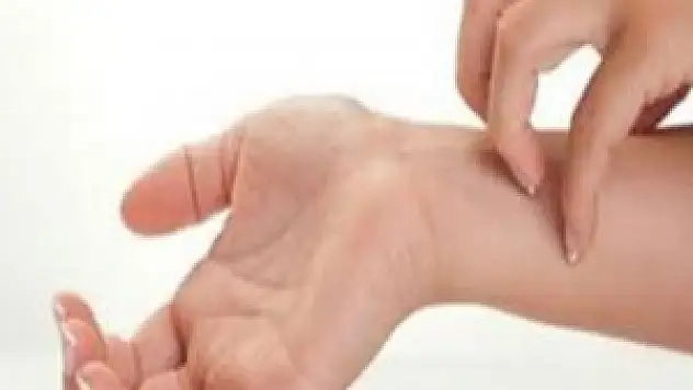 Kaşınıyorsanız ciddiye alın!