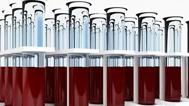 Kan tahlilinde yeni buluş