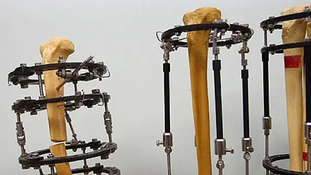 Yerli medikal cihazlarda 'Van' imzası olacak