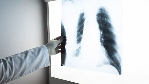 KOAH kamuoyu tarafından yeterince bilinmiyor