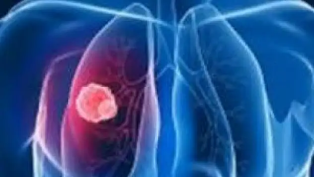 Yılda 1.6 milyon kişiyi vuruyor