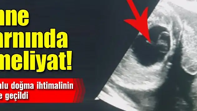 Anne karnındaki bebeğe ameliyat yapıldı!