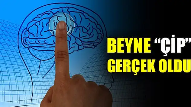 Beyne çip gerçek oldu