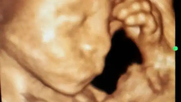 Anne karnında düşünen bebek