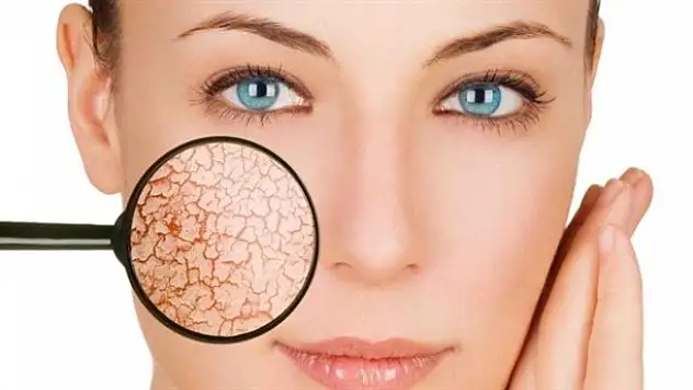 Genetiğe özel kırışıklık kremi