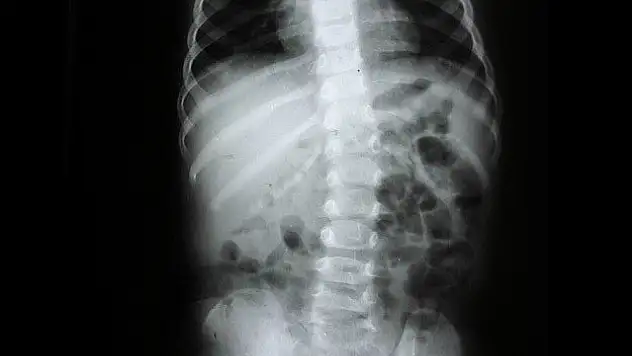 Omurga eğriliğine dikkat