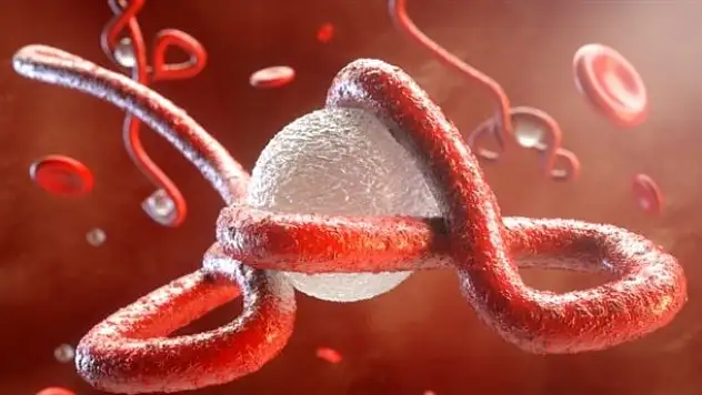 Ebolayı griple karıştırmayın