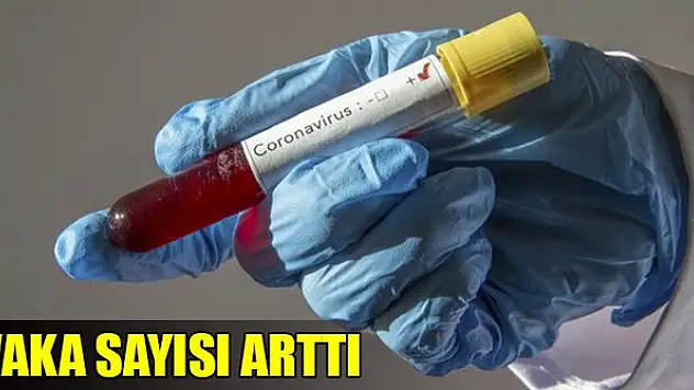 Türkiye'de koronavirüs vaka sayısı 47 oldu