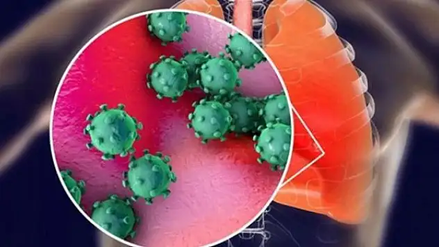 Koronavirüs, hastalarında virüs ölümden sonra bile akciğerlerde varlığını koruyor!