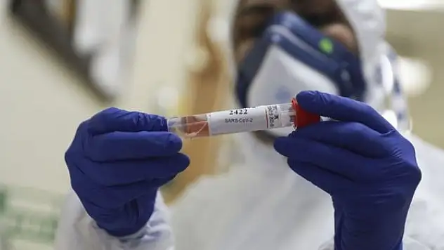 Herkes merak ediyor: Kovid-19 yeniden bulaşır mı?