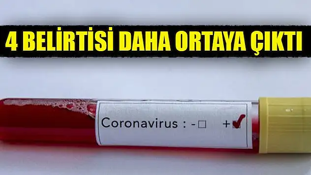 Koronavirüsün 4 belirtisi daha ortaya çıktı