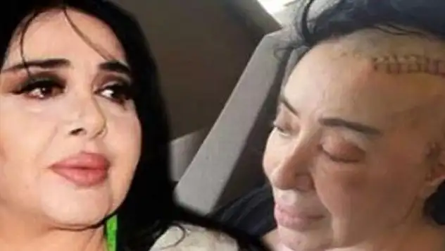 Nur Yerlitaş hayatını kaybetti