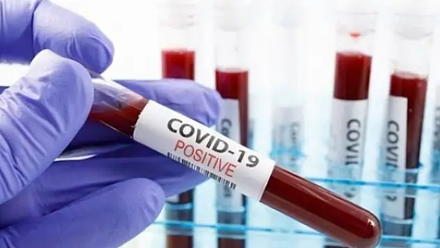 Kovid-19'la enfekte olan erkekler kadınlardan daha fazla antikor üretiyor