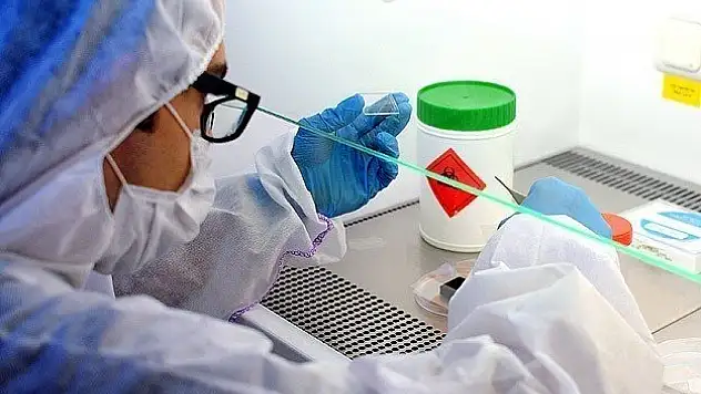 Ebola dakikalar içerisinde test edilebilecek