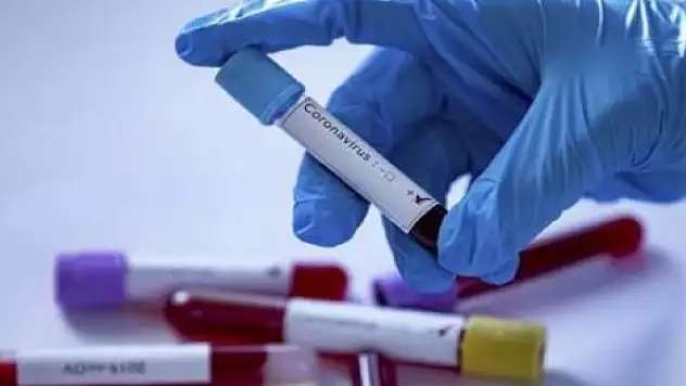 Umut veren sözler: Koronavirüs güç kaybediyor