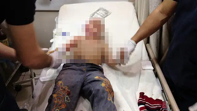 Konya şok olay... Köpek küçük kızı...