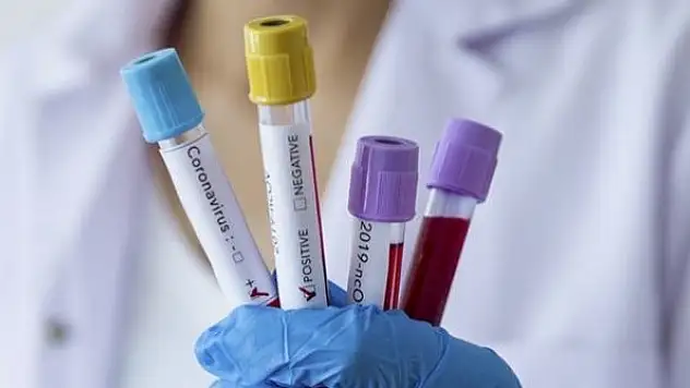 Araştırmaya göre Kovid-19 hastalarında nörolojik semptomlara sıkça rastlanıyor