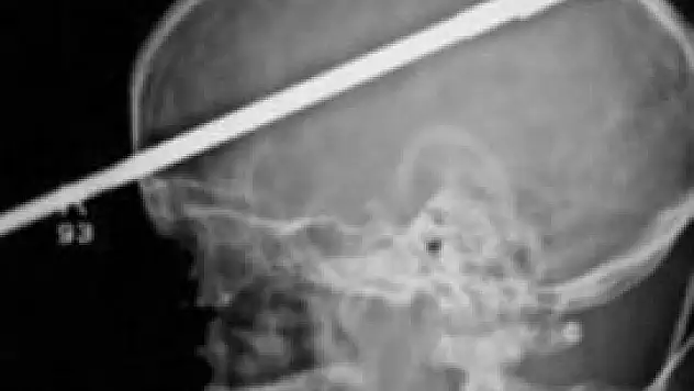 İnanılmaz kurtuluş!