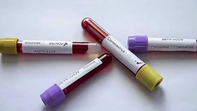 Bilim insanından 'İkinci Kovid-19 tanısında bulaştırıcılık incelenmeli' talebi